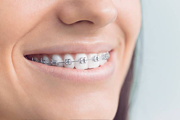 Best Traditional Braces  in Hitchcock, TX